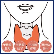 Ancestral hall] The thyroid gland is used for the cold compress physiotherapy of the thyroid nodule lymph nodes