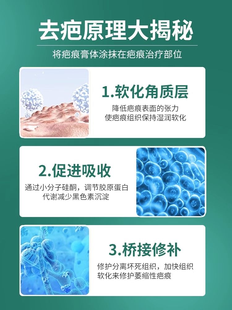 祛疤膏手术烫伤疤痕淡剖腹产凸起瘢疙瘩增生去疤膏除正品旗舰店 - 图0