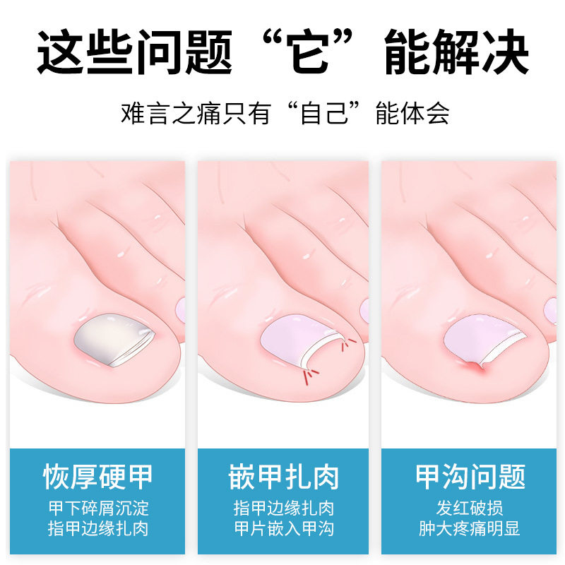 灰指甲甲沟炎德国套装修甲刀 蜜念保健理疗