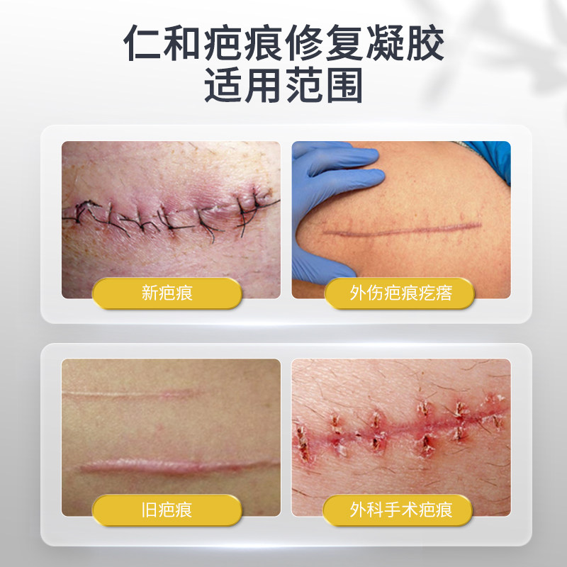 仁和药业疤痕修护凝胶烧伤疤烫伤疤手术疤增生性疤痕淡化抚平GC2_虎窝淘