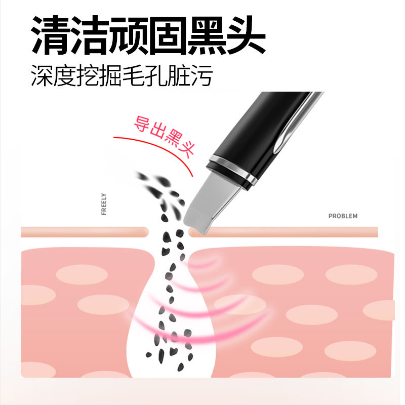 法国vlvee去黑头粉刺神器黑头铲 vlvee电子美容仪