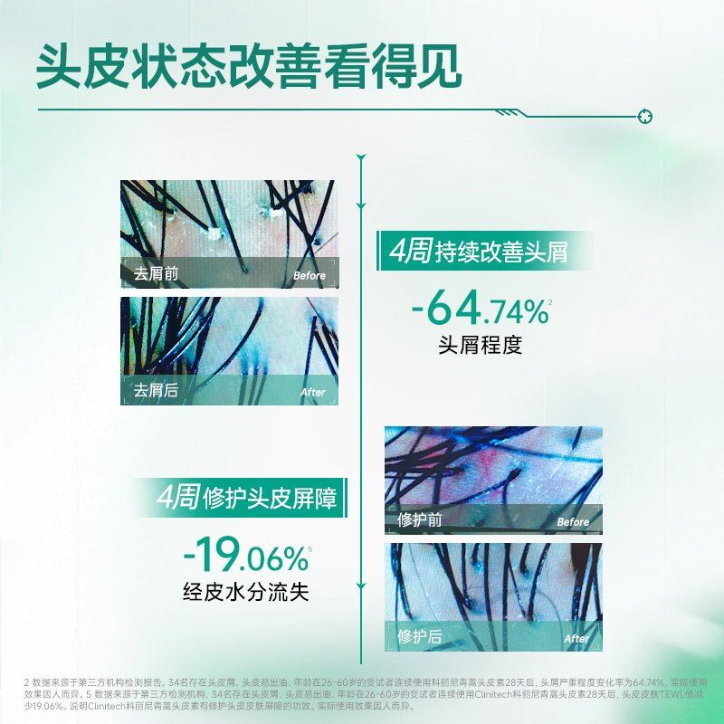 科丽尼青蒿头皮素修护舒缓洗发水去头屑控油清洁头皮护发洗护套组