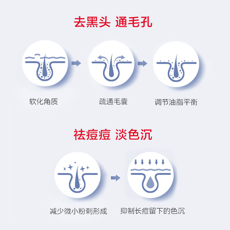 质润15%凝露任二酸凝胶控油壬二酸 知原乳液/面霜