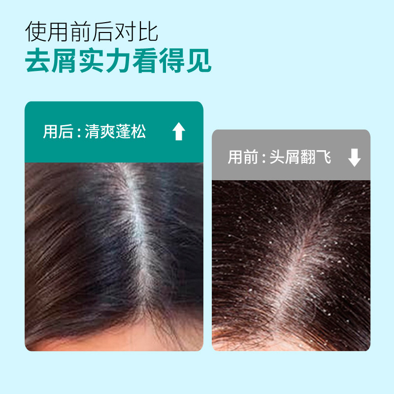 洛芙二硫化硒洗头水去屑止痒洗发水 知原洗发水