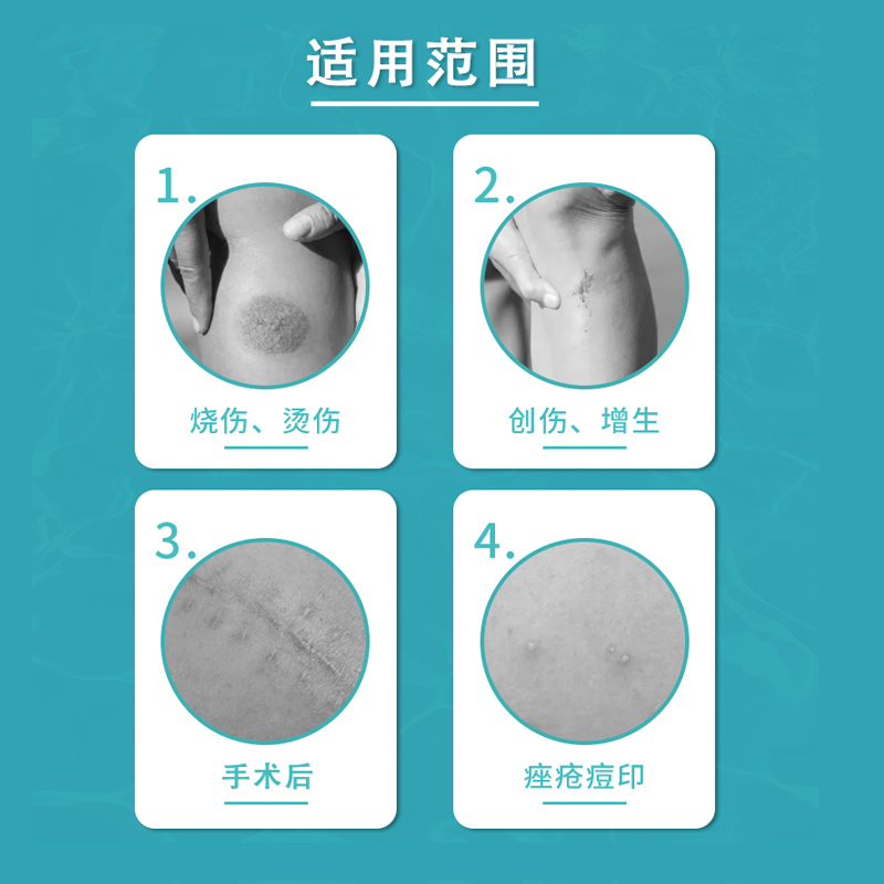 北京同仁堂祛疤膏儿童小孩去疤痕剖腹产痘印烫伤医用硅酮祛疤凝胶
