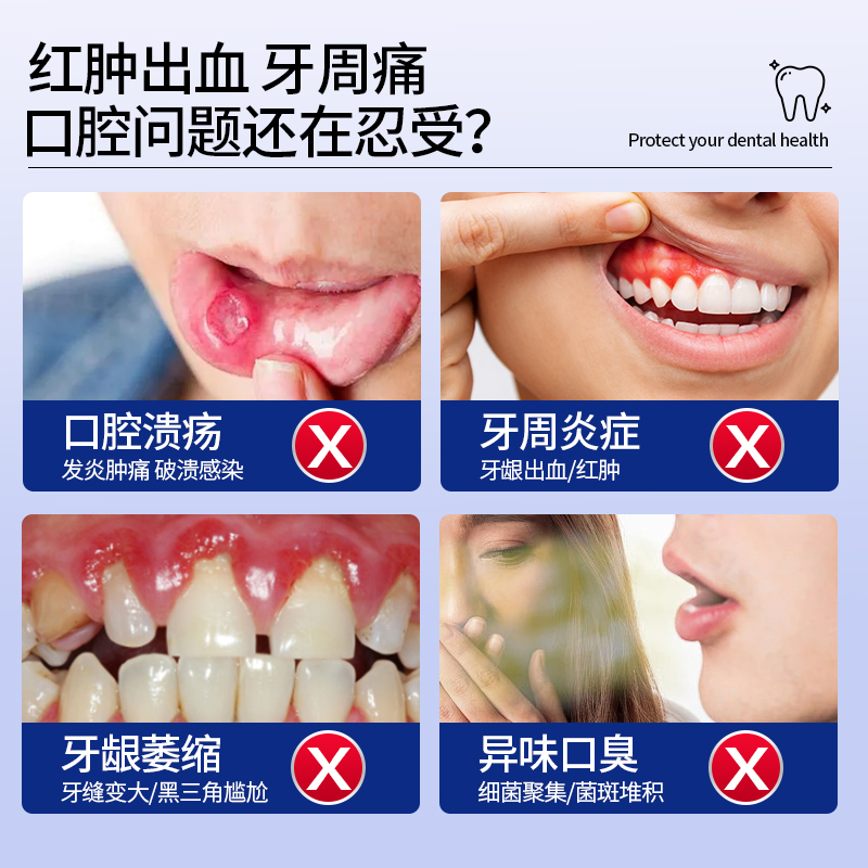 医用漱口水牙周炎杀菌消炎除口臭口腔溃疡清新口气家用旗舰店正品