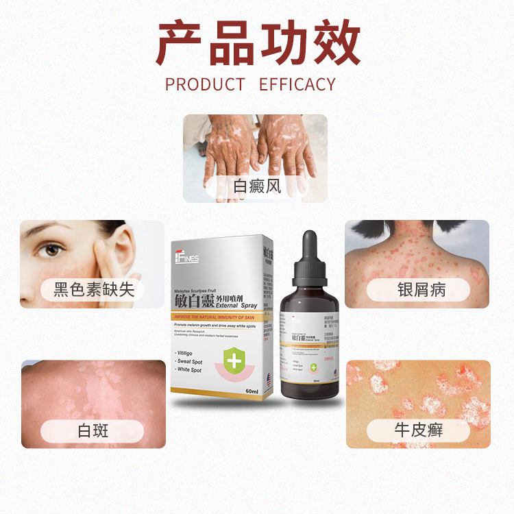 fines敏白灵白班花班白癜风牛皮癣银屑病非鲁索替尼软膏