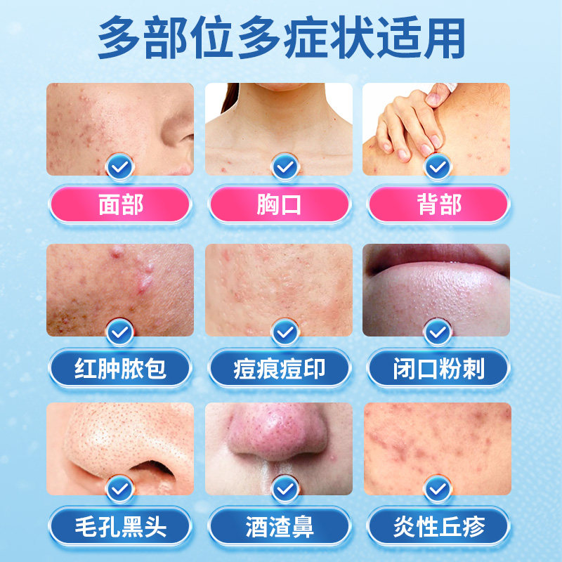 官方旗舰店正品维a乳酸维a酸乳膏 硬核医生医药皮脂汗腺