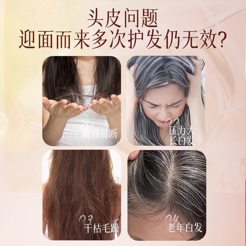 愿秀藏红花何首乌养发精华保健喷雾官方旗舰店正品乌黑密发液1QY,淘宝优惠券,粉丝福利购,淘宝优惠卷