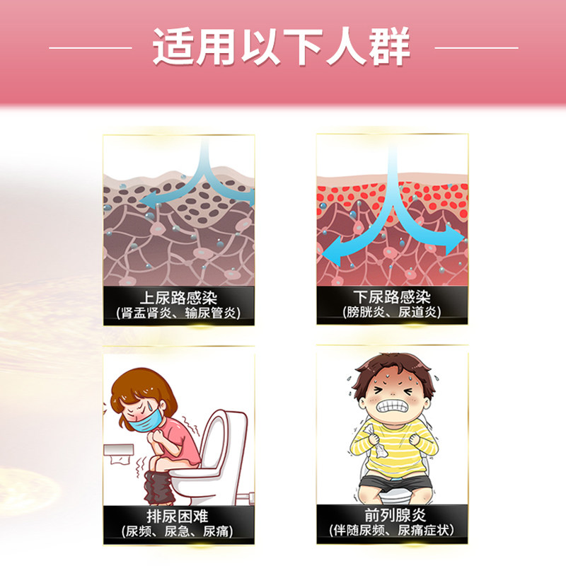 日本松浦五淋颗粒尿频尿急正品中药 康虹药业海外国际男科药品