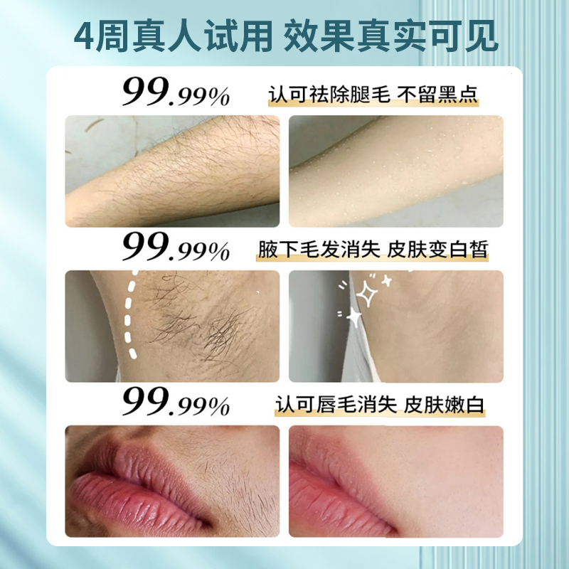 健拓佳脫毛儀家用醫用全身腋下私處長效持久美容電動唇毛脫毛儀器_健拓佳旗艦店_醫療器械