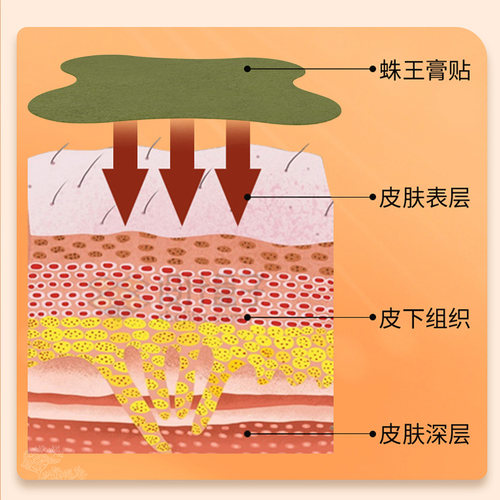 蛛王舒筋通络贴身体贴颈椎腰椎热敷贴发热贴中草药艾草贴膏药贴 - 图1