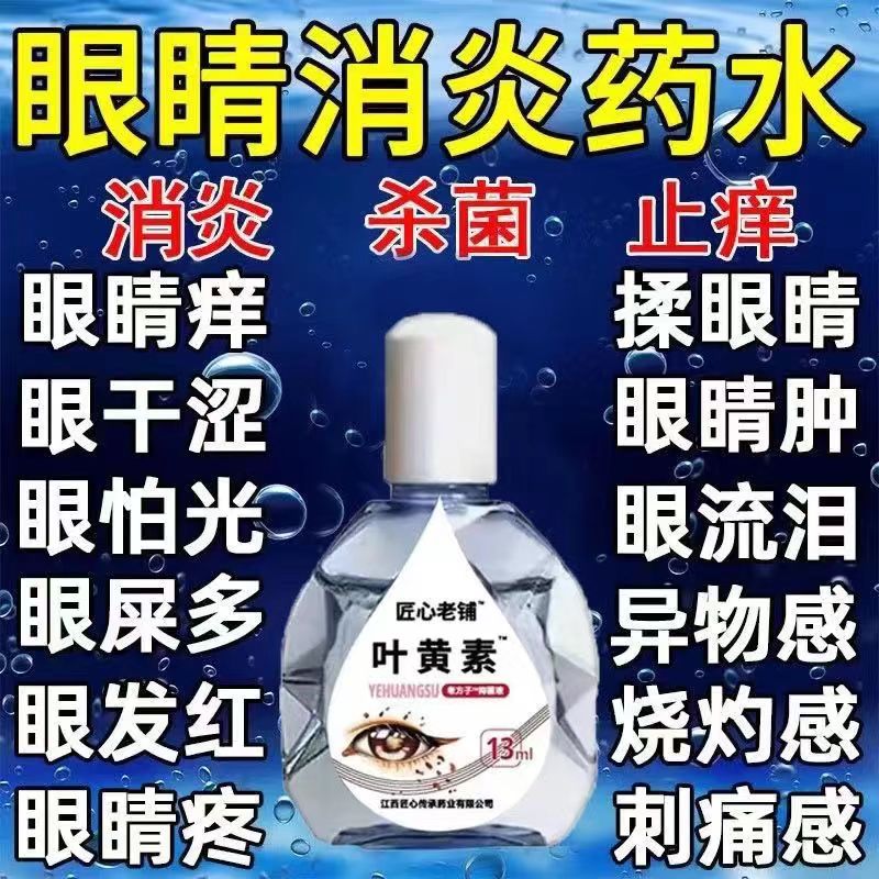 正品眼药水去眼屎红血丝杀菌止痒缓解疲劳干涩异物感怕光流泪眼疼 - 图1