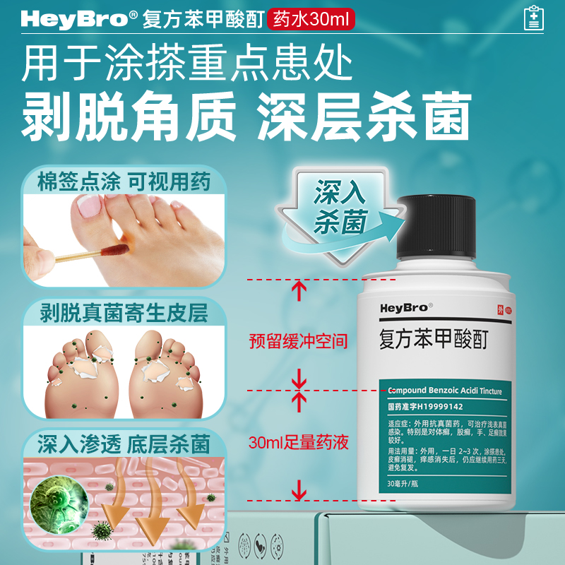 股癣手足癣药膏真菌感染 heybro医药癣症