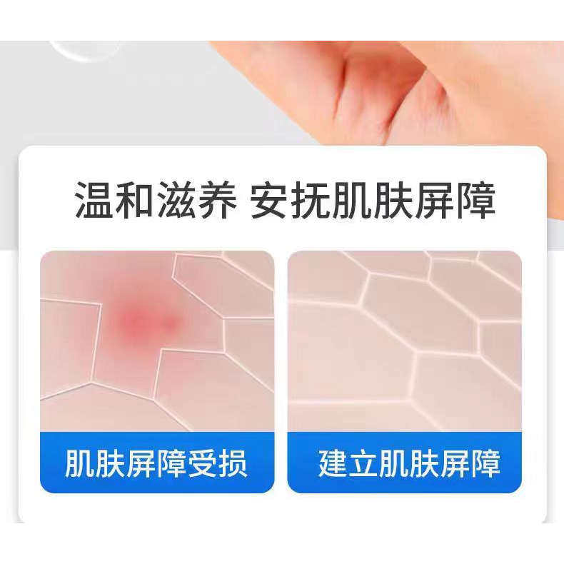 官方旗舰店老款婴亲霜老款正品红痒湿痒痤疮护肤舒缓婴儿宝宝儿童,淘宝优惠券,粉丝福利购,淘宝优惠卷