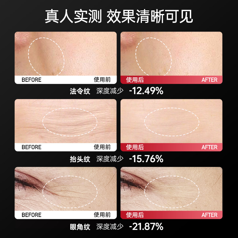  konka康佳十星电子美容仪