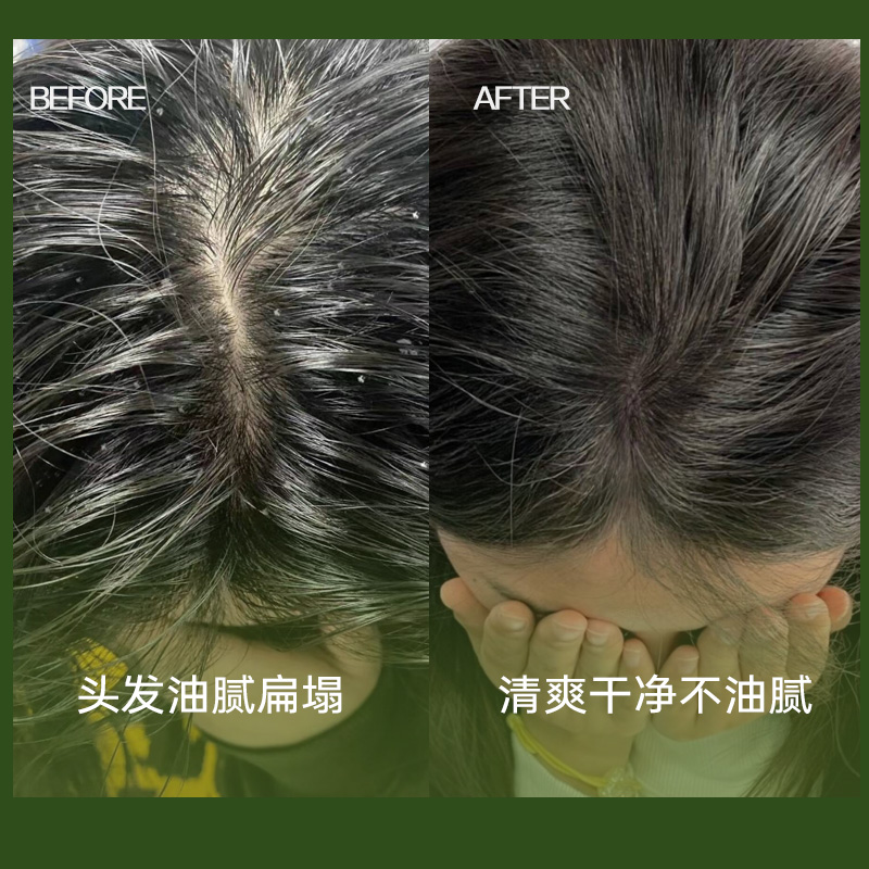 EMWM白池花沐浴露洗发水果酸多肽控油持久留香蓬松去屑止痒