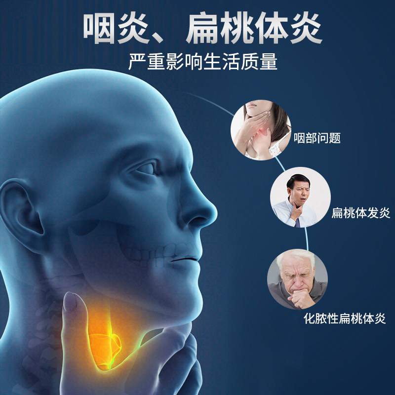 慢性咽炎咽喉炎穴位贴扁桃体发炎 祖医堂芙顺堂膏药贴（器械）