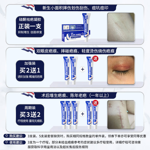 美国疤克祛疤膏官方旗舰店芭巴克去疤膏去疤痕修复膏除疤膏疤痕贴 - 图0