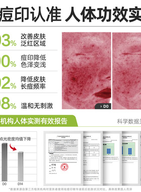 鲜一祛痘印淡斑377美白精华