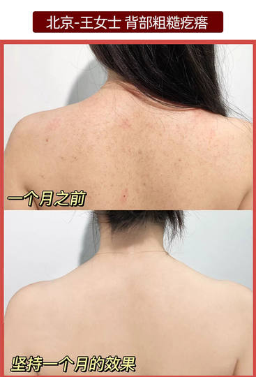 La leche con vitamina E, crema de urea Baozhongbao clásica de marca antigua nacional, mejora la hidratación, humecta y previene la sequedad, auténtica para hombres y mujeres.