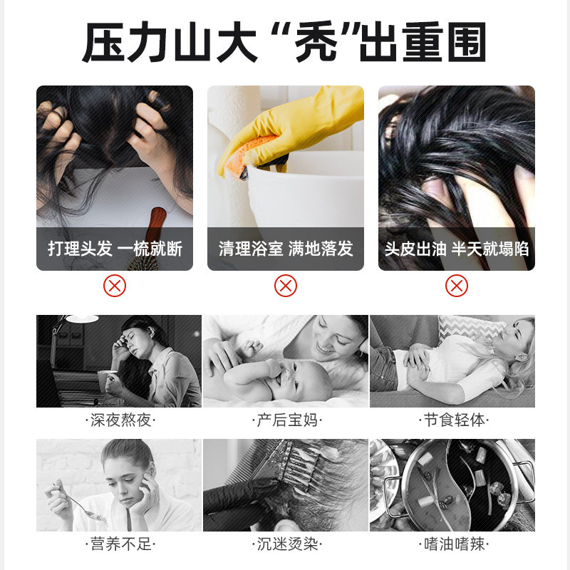 维生素b6防脱发掉头发b族复合肌醇 Vitanergy海外B族维生素