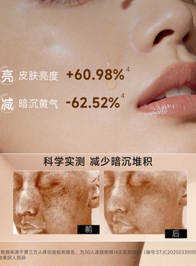 氨甲环酸祛黄提亮修护舒缓敏感肌