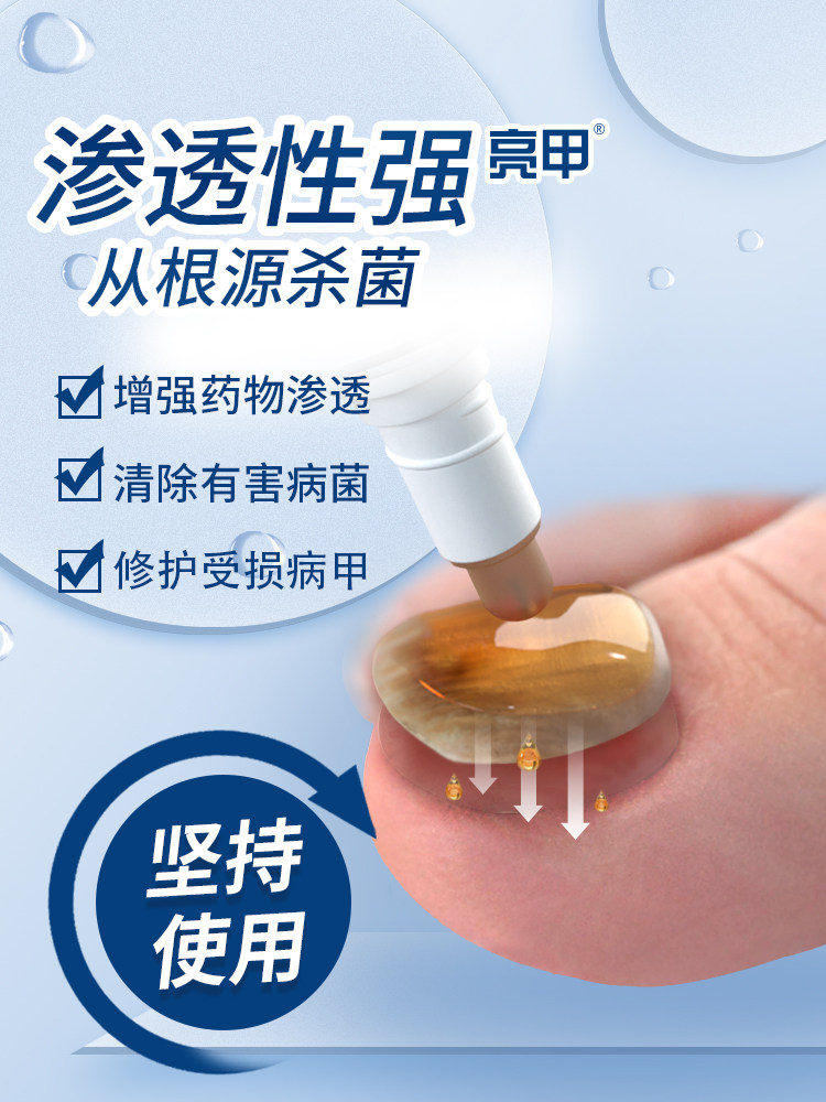 亮甲复方聚维酮碘4ml*4去液搽剂 楚蕴家庭医生大药房癣症