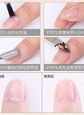 专业去死皮手指甲工具套装