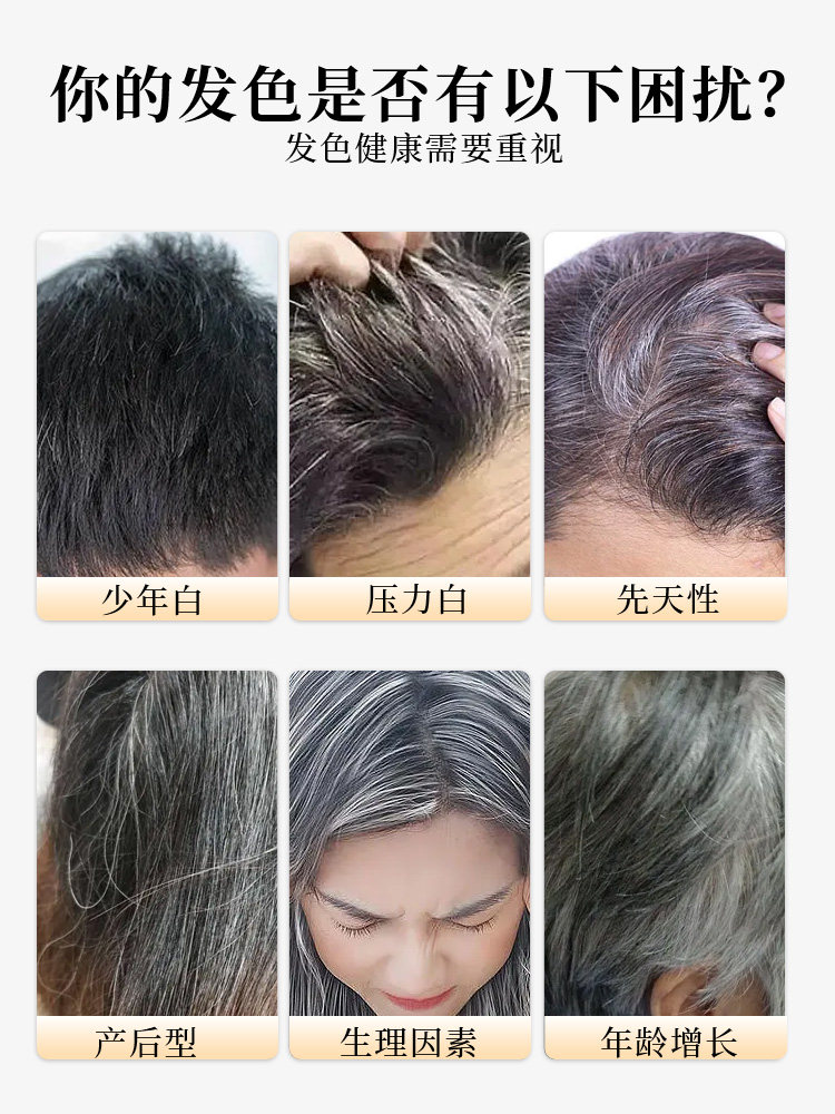 澳洲CareMagic黑发片生物素防脱复合维生素B官方旗舰店原装进口,淘宝优惠券,粉丝福利购,淘宝优惠卷