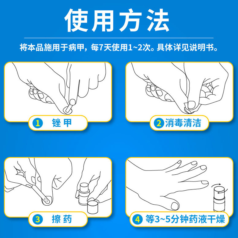 楚甲盐酸阿莫罗芬搽剂正品专用药 福录寿大药房癣症