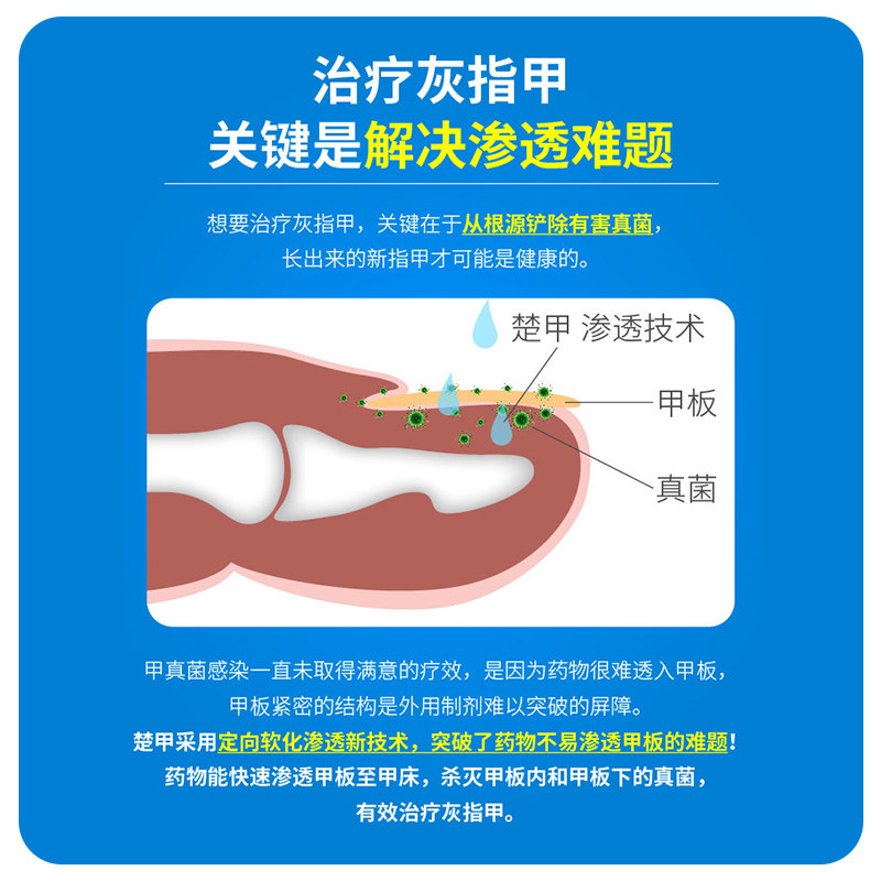 楚甲盐酸阿莫罗芬搽剂正品专用药 福录寿大药房癣症