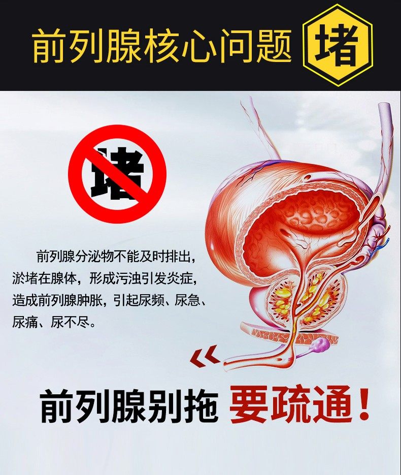 祖医堂缐宝辅助治疗慢性前列腺增生 祖医堂施美达膏药贴（器械）