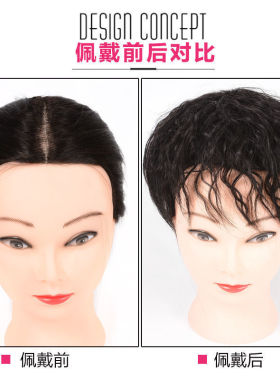 头顶补发片中老年妈假女短
