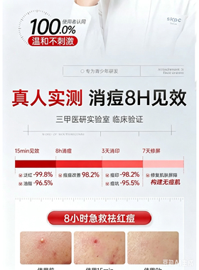 荷黛儿玉容散补水舒缓祛痘面霜男女学生青春痘荷黛儿玉蓉膏玉容秀