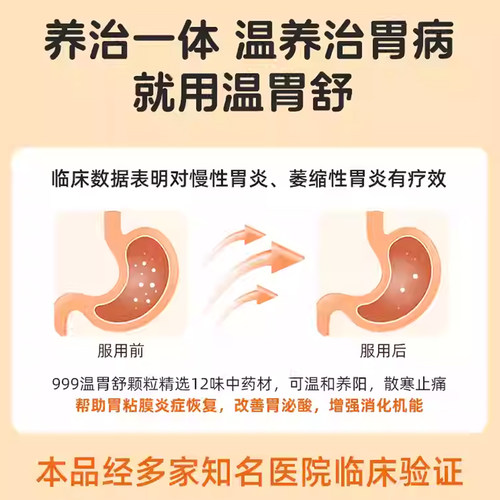 999三九胃泰温胃舒颗粒中成药胃药止痛慢性胃炎药官方旗舰店正品 - 图1