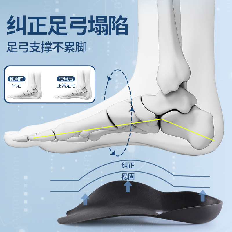 扁平足矫正鞋垫适用于型腿矫正器x腿型小腿外翻直腿神器足弓纠正