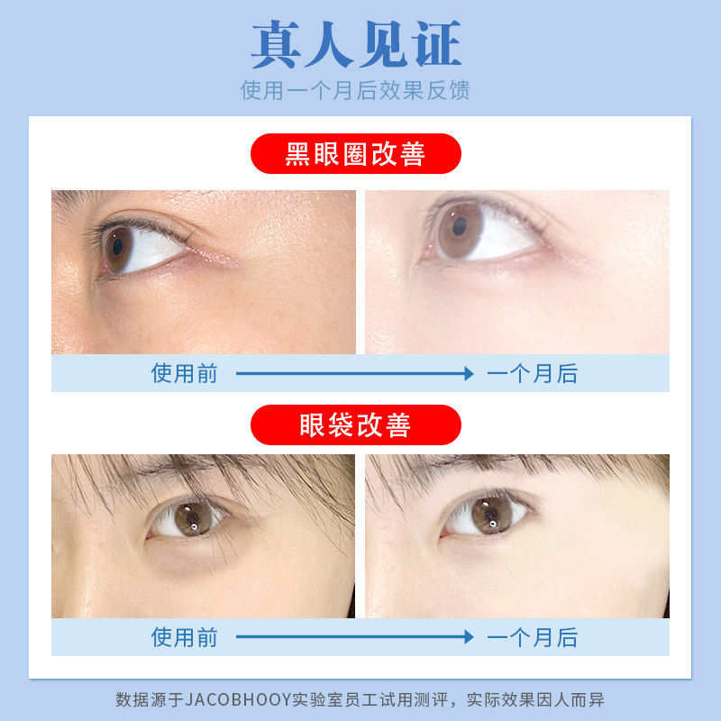 进口去除黑眼圈淡化细纹抗皱女眼霜 jacobhooy海外眼霜