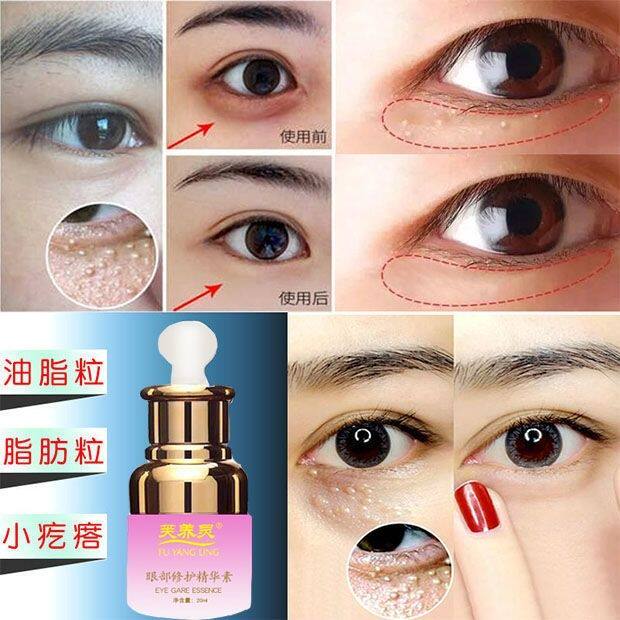 眼周脂肪粒 新人首单立减十元 21年8月 淘宝海外