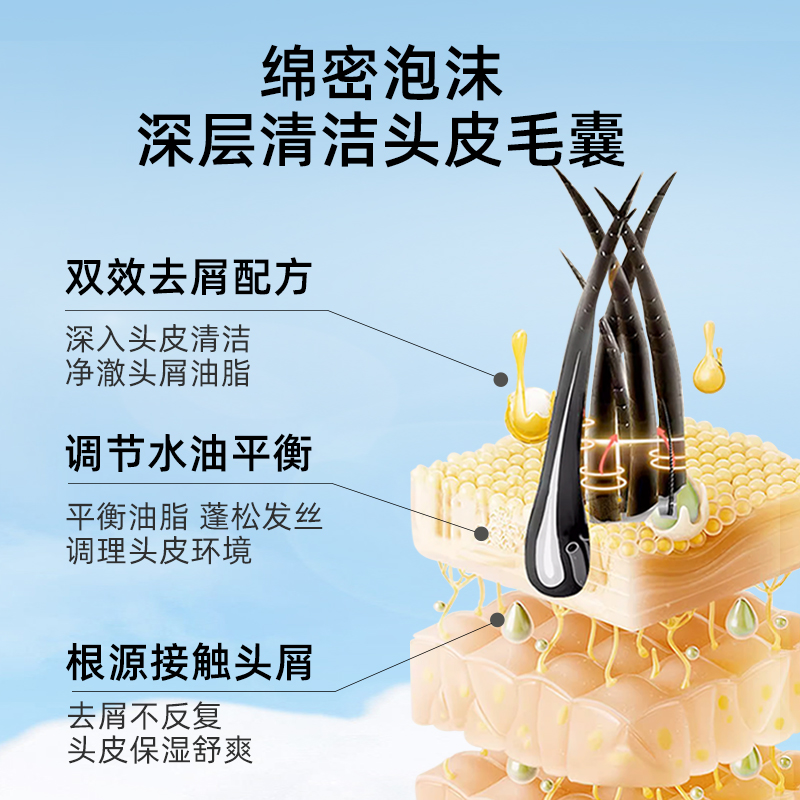 斯必申去屑蓬松洗发水135ml/瓶二硫化硒控油止痒液脂溢性皮炎