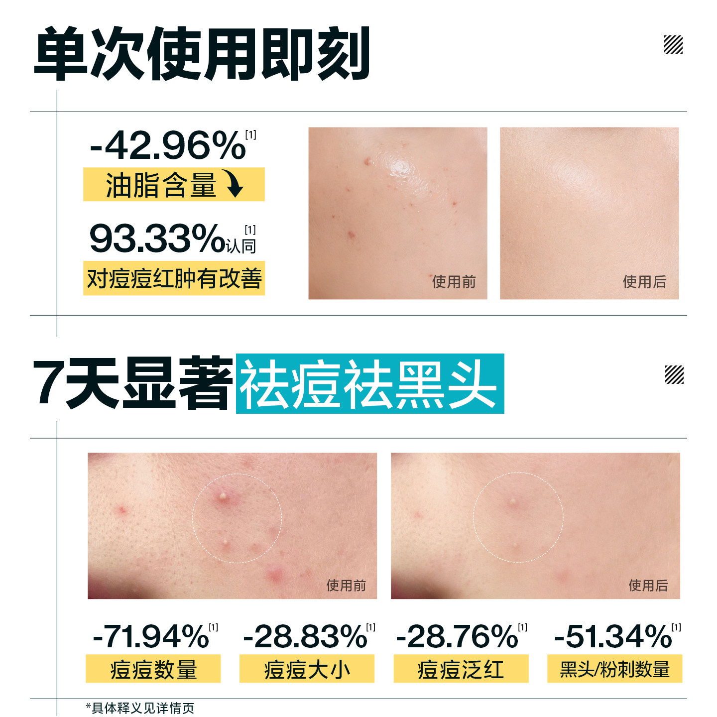 欧豪同款海洋至尊三棱镜祛痘洗面奶男士专用控油氨基酸洁面乳套装