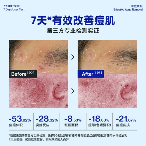 海洋至尊 Увлажняющий комплект для ухода за кожей, увлажняющее очищающее молочко, контроль жирного блеска, анти-акне, 3 предмета