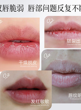 Anchuyt维生素原B特护润唇精华油修护补水保湿滋润润唇膏基础包装