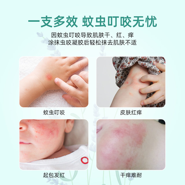 Berbian infant worm bite gel 20g bites flea bug biting gel baby children's skin care ordering two hair