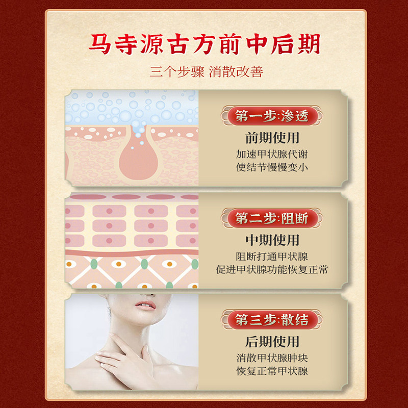 甲状腺结节消散贴膏专用甲亢桥本囊肿外用膏贴调理脖子粗大硬块型