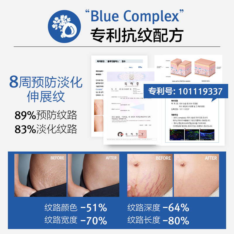 康康妈咪孕妇专用产前妊娠纹修复霜 tntnmoms母婴海外妊娠纹护理