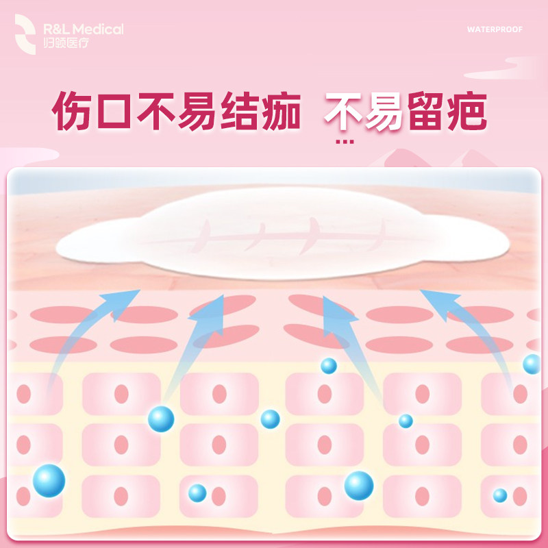 归领医疗水胶体创可贴医用防水透气创口贴宝宝防抓扣伤口贴人工皮