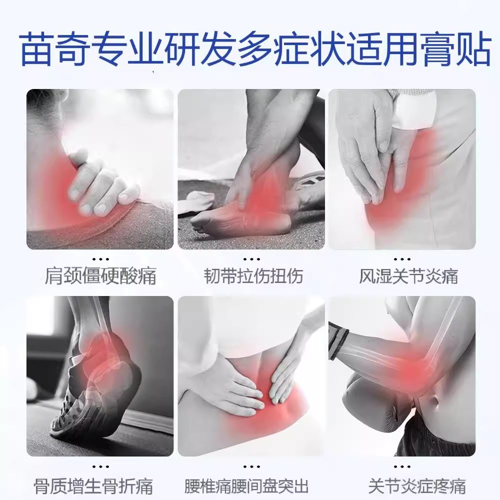 苗奇风湿关节炎痛贴贵州苗药专关节麻木关节肿胀风湿关节炎用膏贴