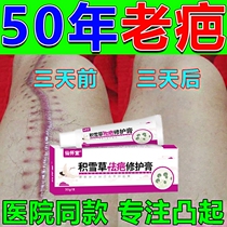 Snow grass scar removing scar Scar Hyperplasia Bulge Removing Goose Bumps And Caesarean Cesarean Burn Scalpel Scar Repair Paste Scar Repair Cream Knife Scar