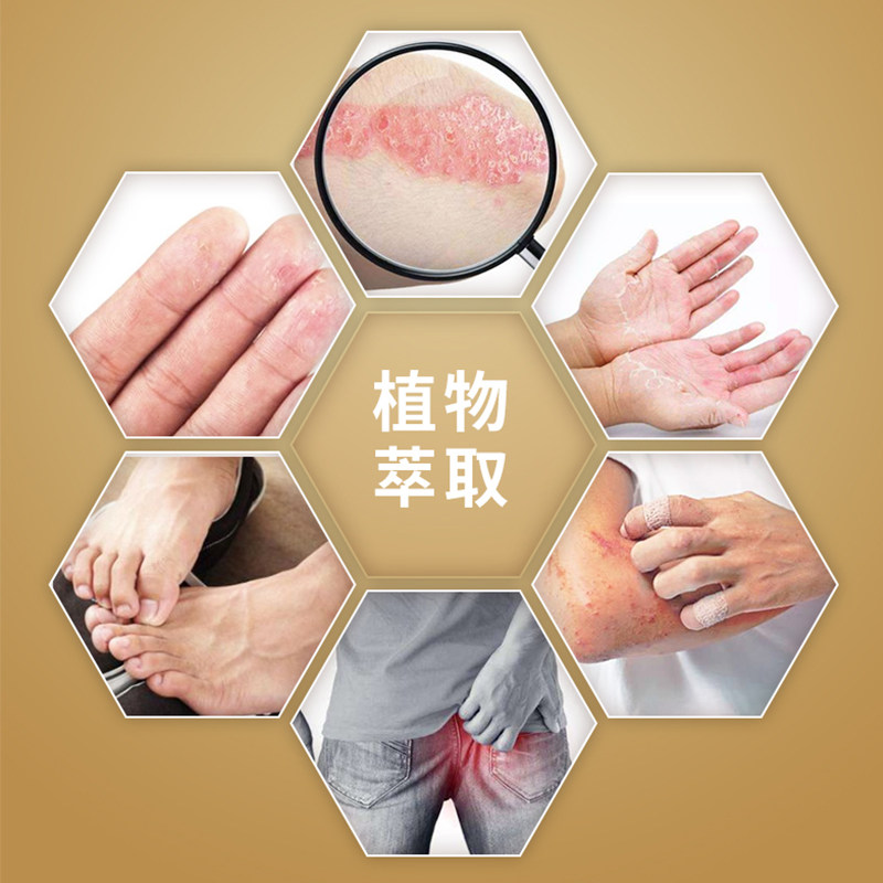 健源堂菌必净抑菌瘙痒膏强效皮肤膏 健源堂皮肤消毒护理（消）